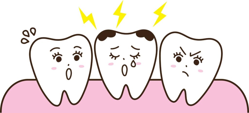 虫歯 放置すると