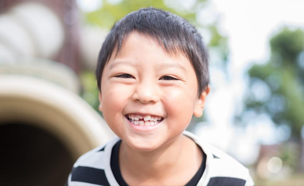 子ども 歯並び 悪い