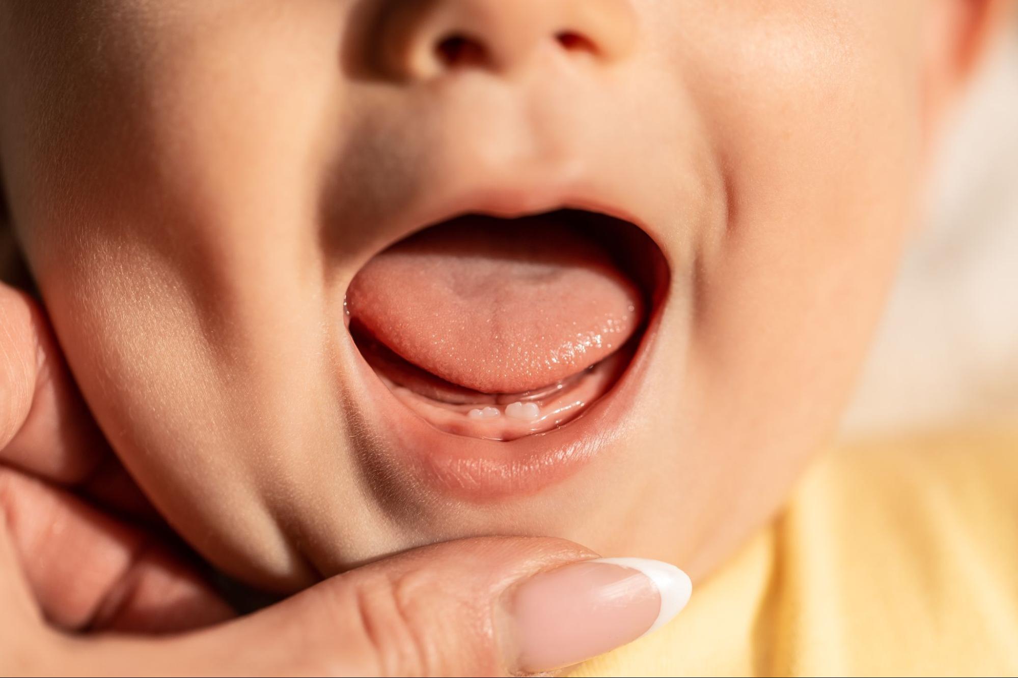 子ども 歯 生え変わり