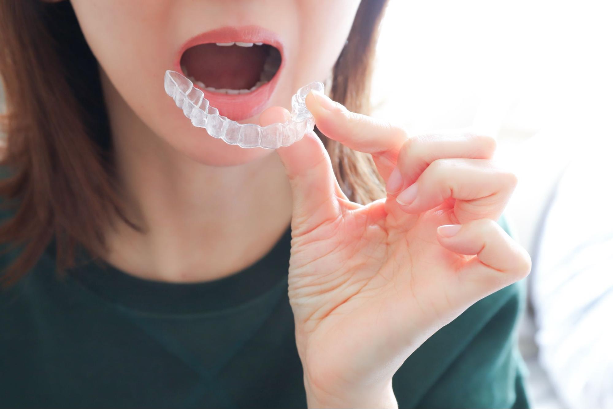 インビザライン やり直し