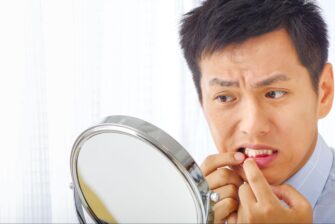 マウスピース 口内炎